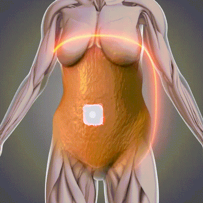 🔥 40% OFF | South Moon Slim & Burn Patch™